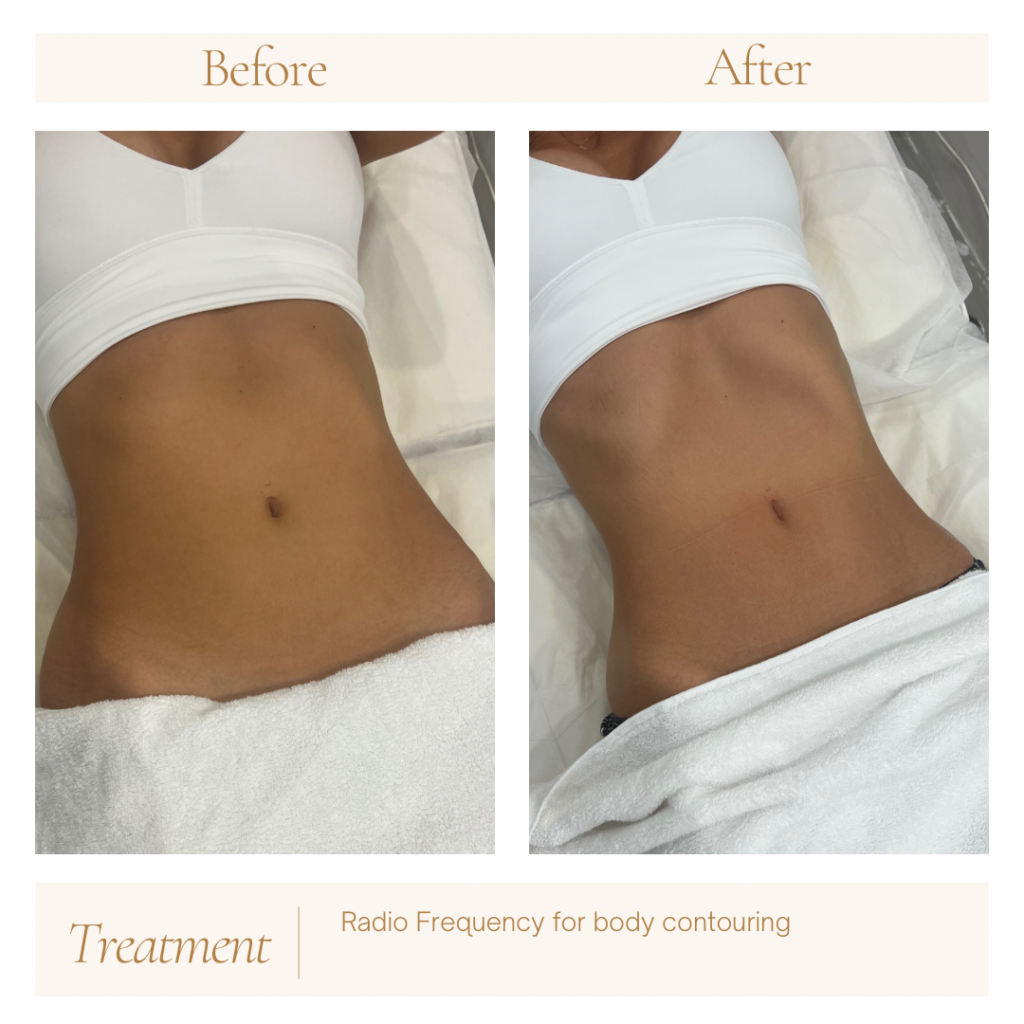 4178F365-80E0-4829-8672-068E7D979A79