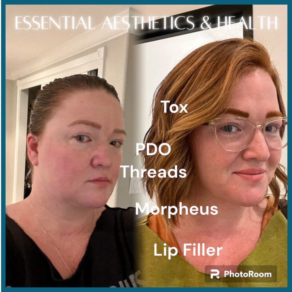 0B1DBDEE-2DB4-40FD-8003-5EF0E18F6B0D