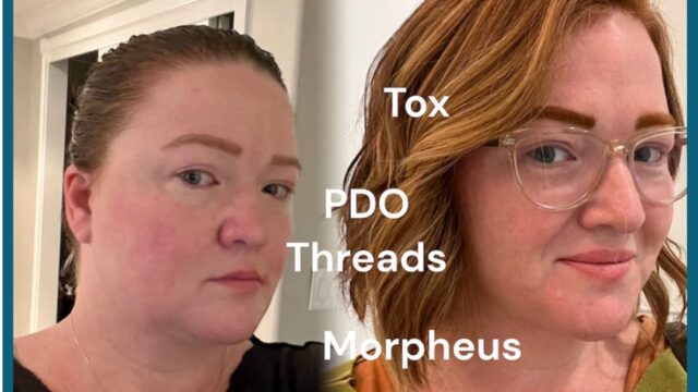 0B1DBDEE-2DB4-40FD-8003-5EF0E18F6B0D