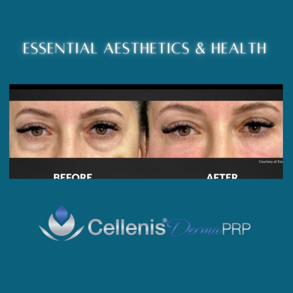 Copy-of-Derma-PRP-Marketing-Kit-DMK-37