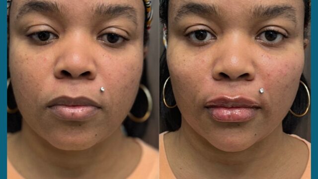 ESSENTIAL-AESTHETICS-HEALTH-1