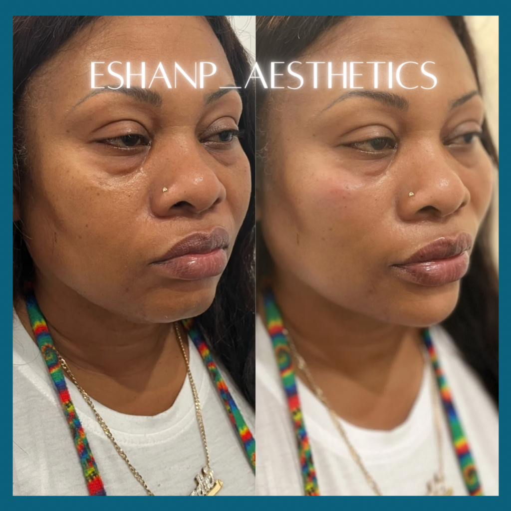 F6ABA721-CBEC-42C5-A80F-8137FF6FAA9B