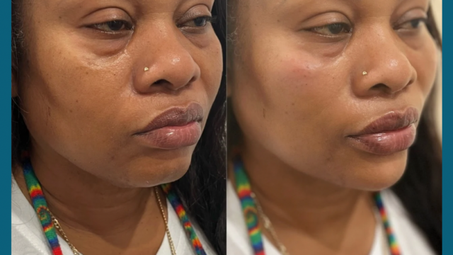 F6ABA721-CBEC-42C5-A80F-8137FF6FAA9B